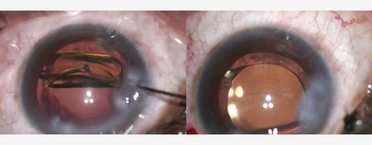 figura 2 el paciente de la figura