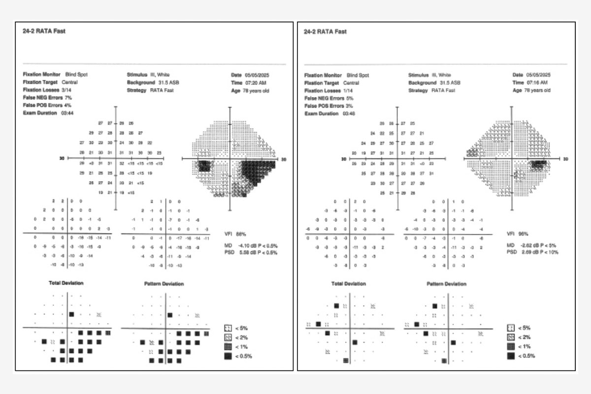 figura 3 un ejemplo de un mal candidato1