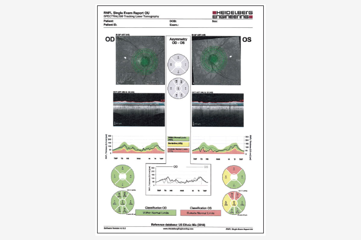 figura 3 un ejemplo de un mal candidato2