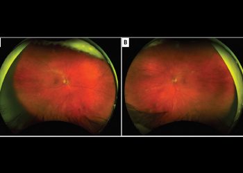 Los residentes de Wills Eye exponen su serie de casos clínicos