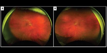Los residentes de Wills Eye exponen su serie de casos clínicos