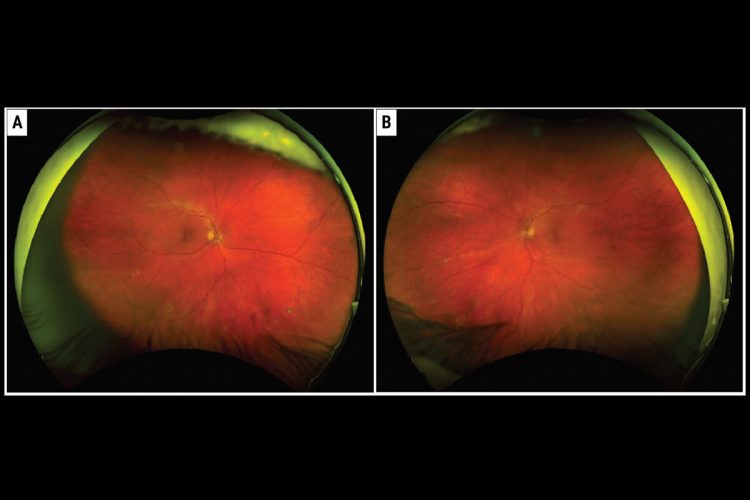 Los residentes de Wills Eye exponen su serie de casos clínicos