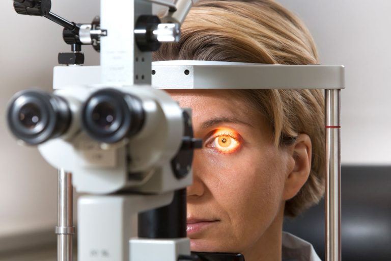 Alta miopía modifica patrones de daño glaucomatoso