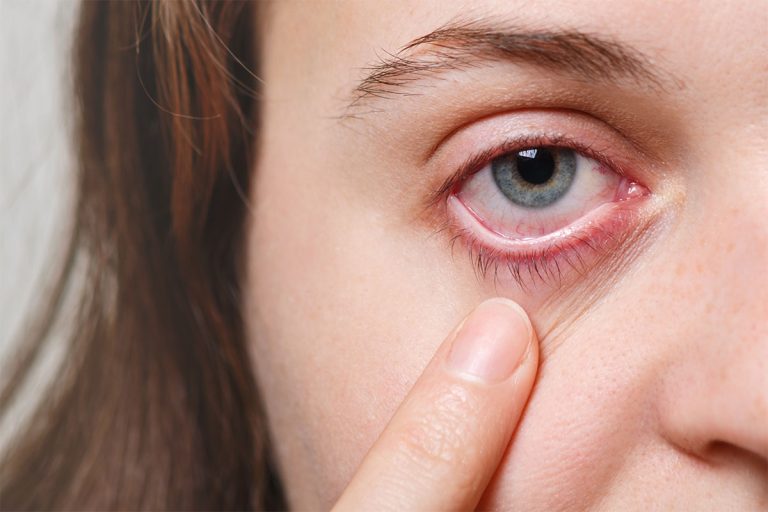 IA analiza el ojo para detectar anemia