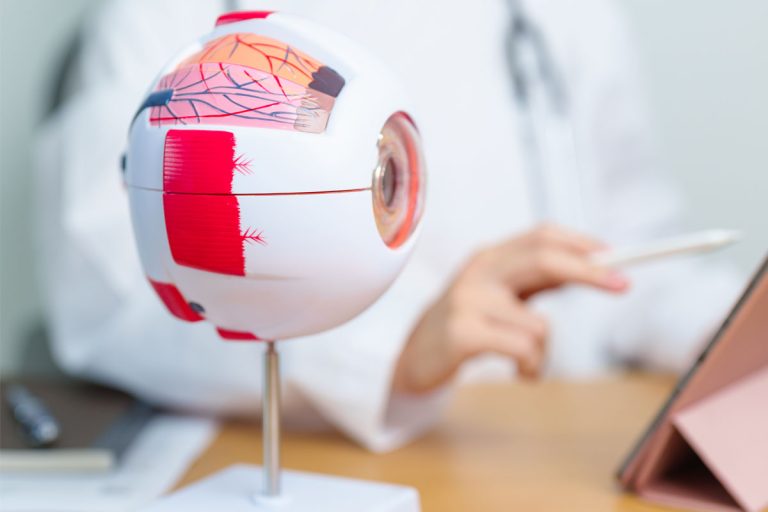 La diabetes aumenta el riesgo de queratitis ulcerativa